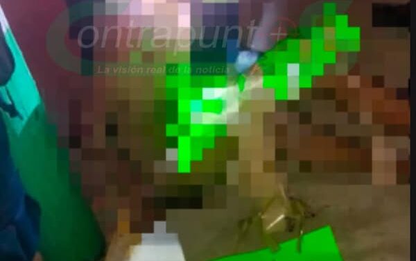 Cuerpos policíacos y de emergencia de Tula de Allende, atienden reporte de un hombre atado a un poste