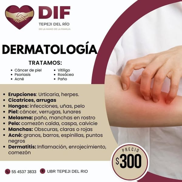 DIF Tepeji ofrecerá consultas de especialidades