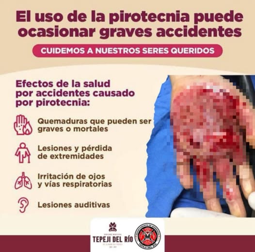 Protección Civil de Tepeji recomienda evitar el uso de pirotecnia