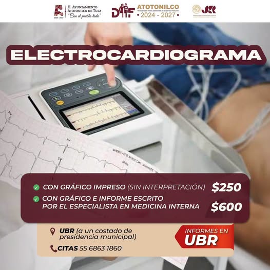 DIF Atotonilco de Tula invita a la población a cuidar la salud del corazón con el servicio de electrocardiograma